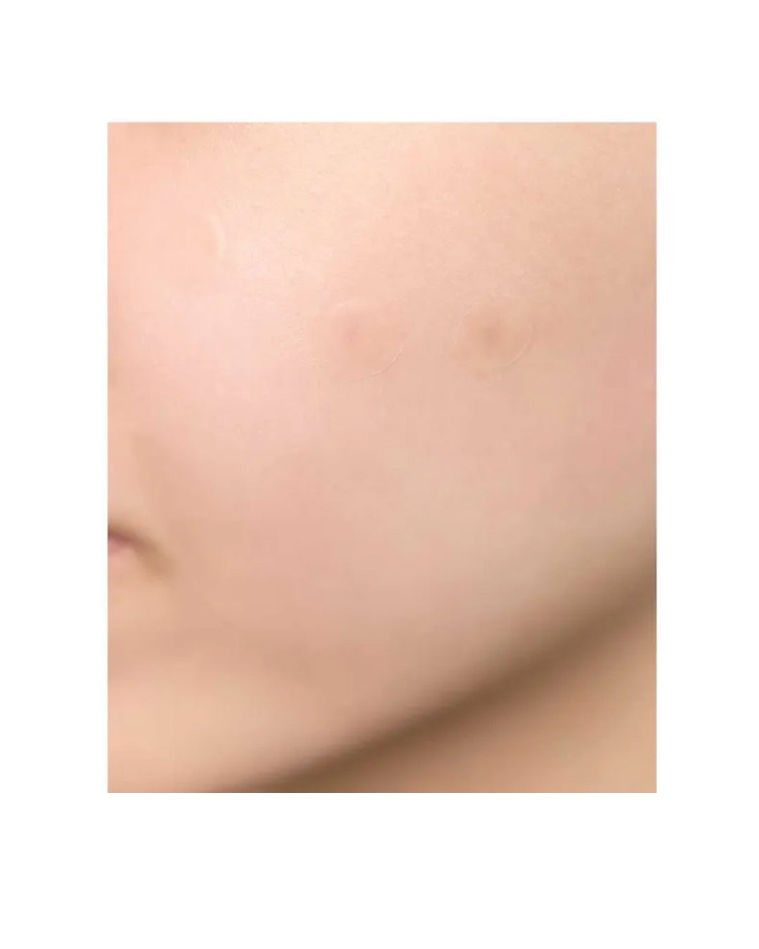 SKIN1004 - Parches para Imperfecciones Spot Cover Patch Tea-Trica
