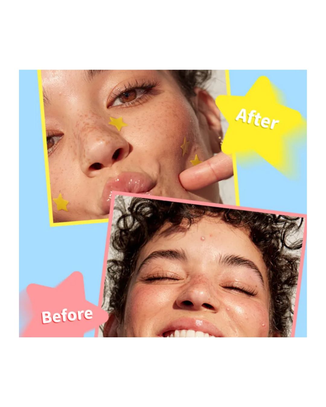 MLSMILE - Smile Star Pimple Patches